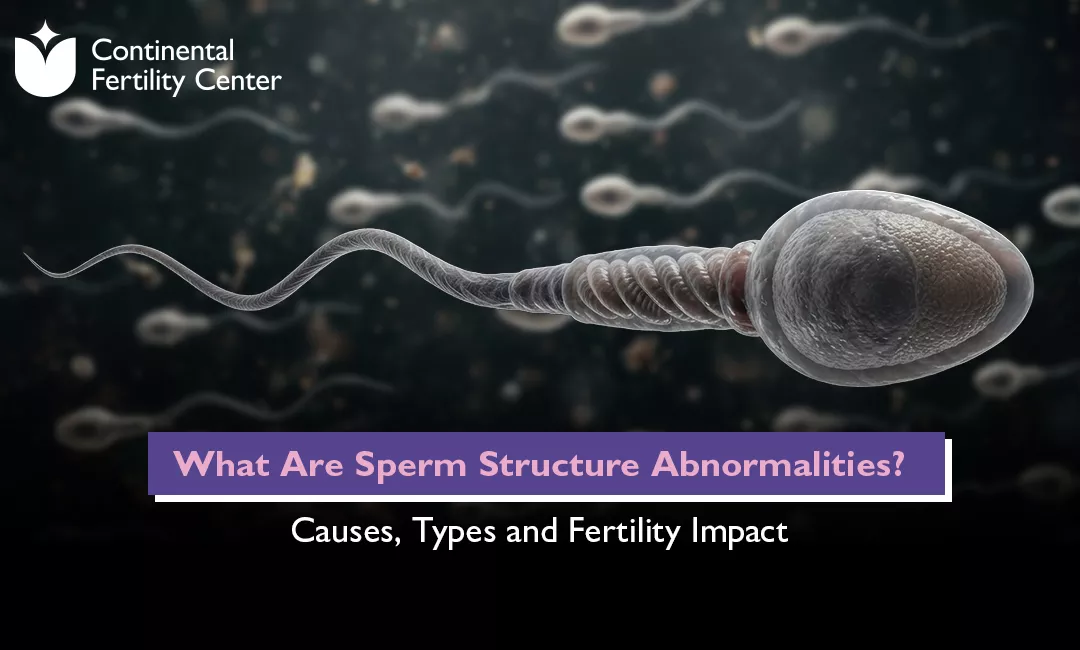 blog-post-image
